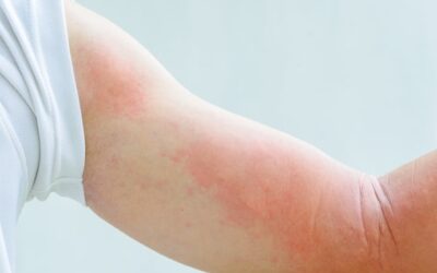 Causes of Itchy Skin