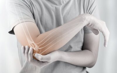 Hidden Risk Factors that May Contribute to Osteoporosis