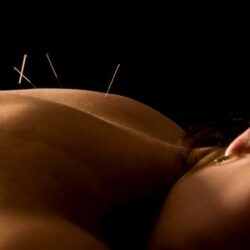acupuncture_washington_dc