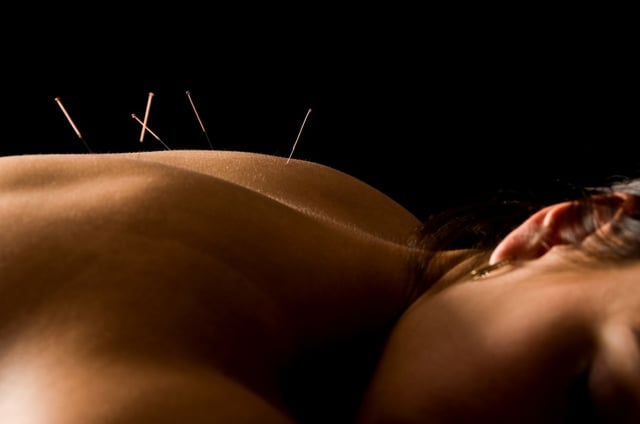 acupuncture_washington_dc