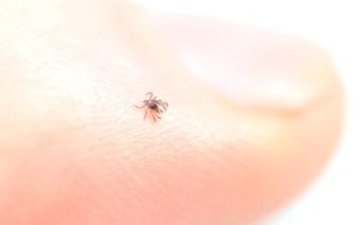 Yeast, or Candida, Can Really Mess with Lyme Disease